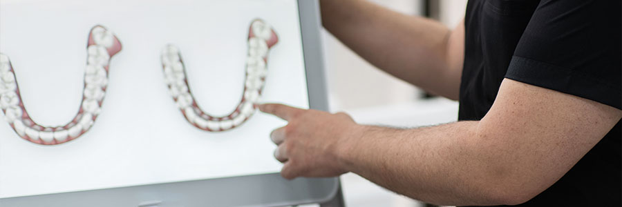 Painless Root Canal Treatment