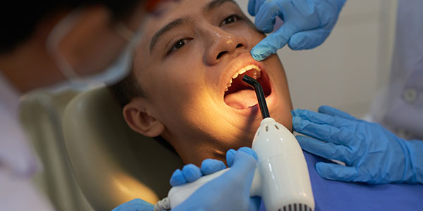 Painless Root Canal Treatment